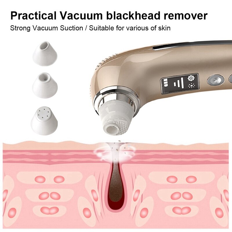 Comedondrukker Vacuüm Zuig Gezicht Huid Bescherming Puistje Remover Tool Porie Reiniging Apparaat Gezicht Schoner Machine