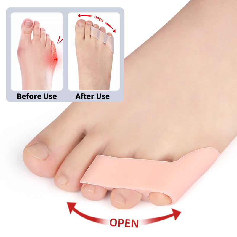 2 Stück = 1 Paar Zehen abscheider Separateur d'ortei Hallux Valgus Korrektor 3 See kleine Ballen Orthesen Schutz Pedikübetreffend Einsteller