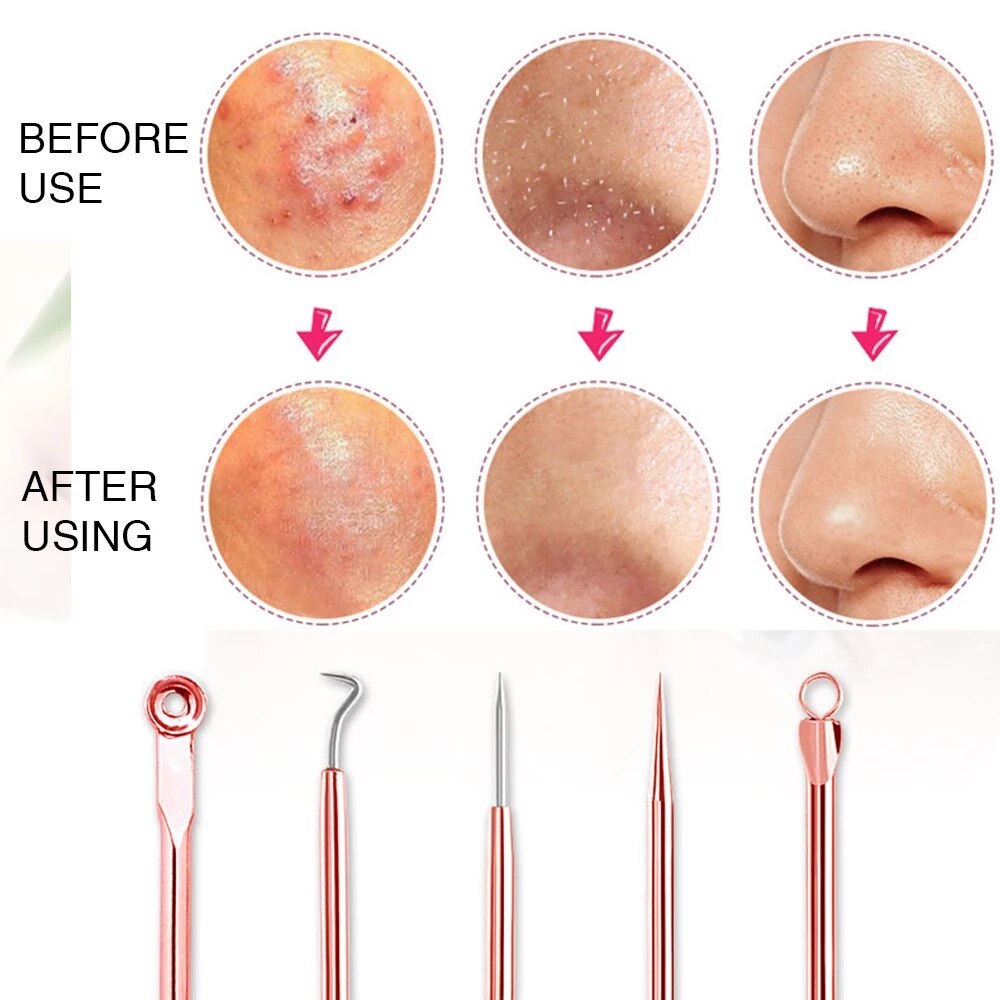 Stainless Steel Blackhead Removal Tool 10set Blackhead Acne Needle Freckles Powder Removal Needle Set Black Spot Pore Cleanser