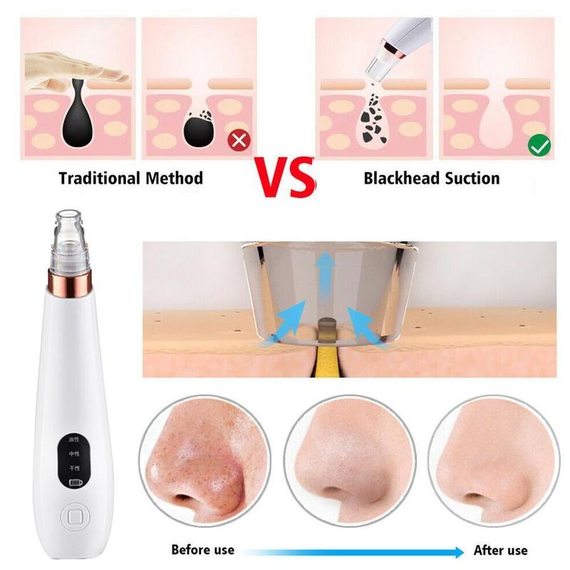 Electric Blackhead Remover Pore Cleaner Blackhead Acne Cleanser Household Artifact Cleaner