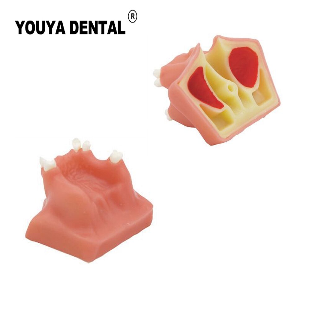 Teeth Implant Practice Model Maxillary Sinus Tooth Implant Model For Dentist Student Training Teaching Material