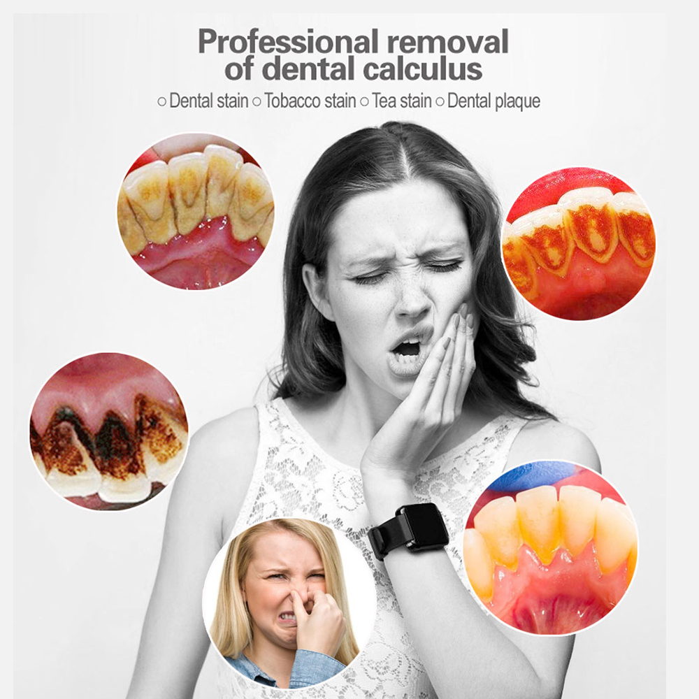 Electric Ultrasonic Teeth Cleaner Dental Tartar Remover Tooth Cleaning Whitening Scaler Dental Calculus Remover Oral Irrigators