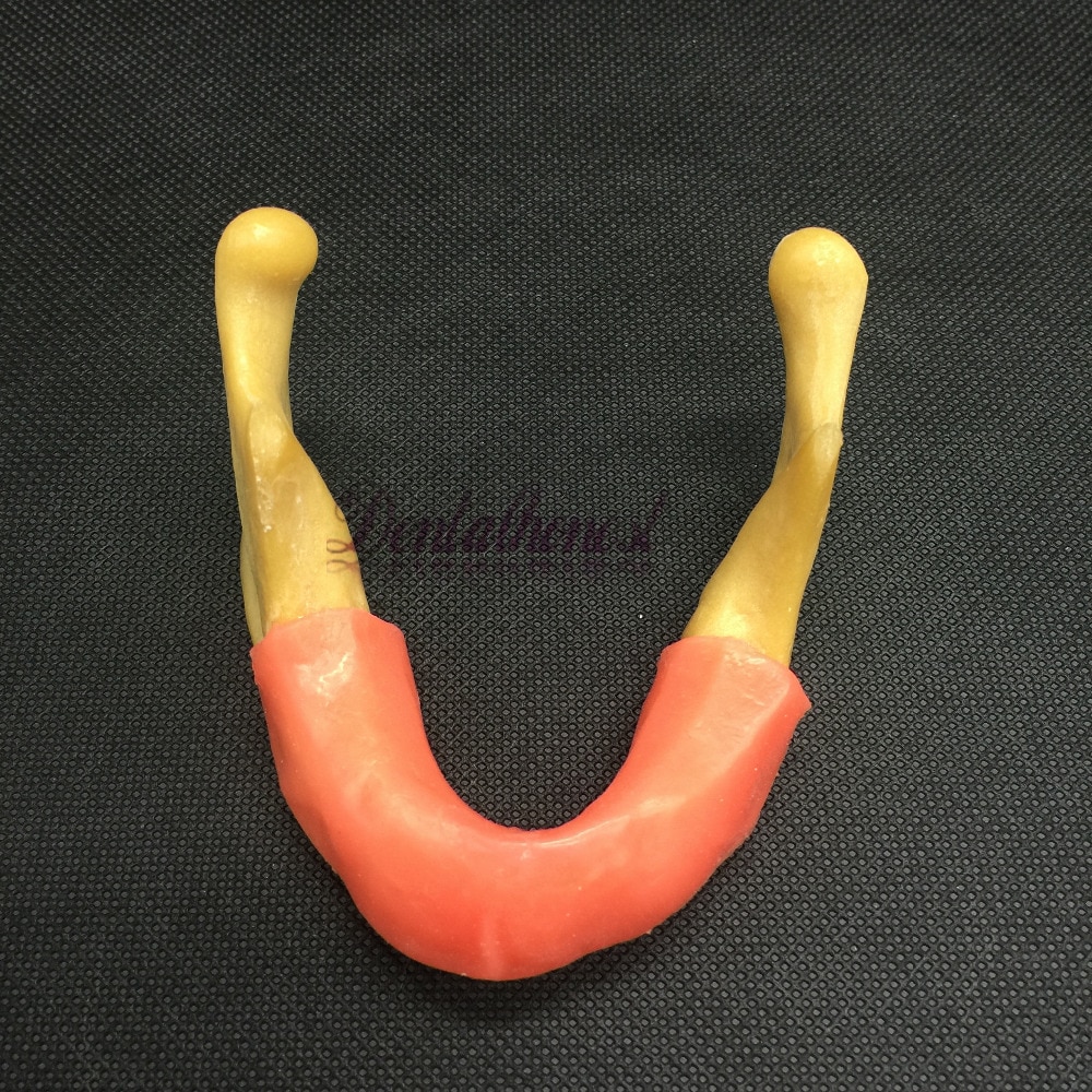 Dental lower jaw implant model simulation of human vicedeal
