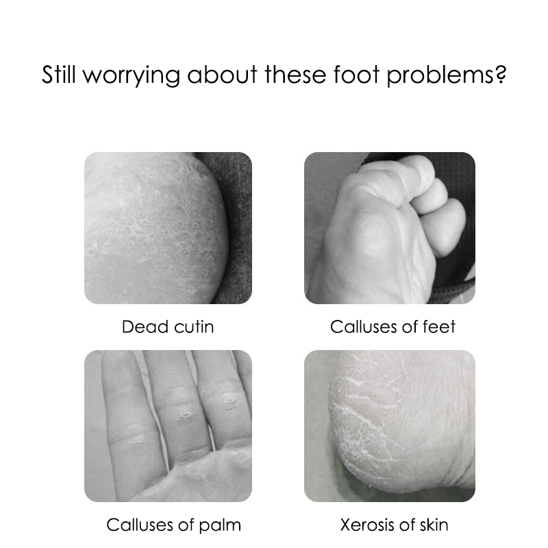 Narzędzia robić pedicure, pilniki robić pięt, artefakt robić złuszczania, szczotka robić usuwania odcisków, nierdzewna stal, ostrzenie stóp, dwustronna pedicura