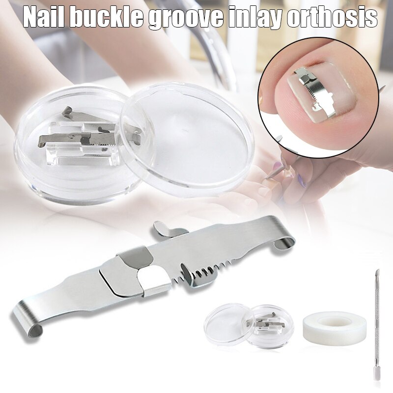 Ongles Boucle De Clip En Acier Inoxydable Incurvé Redresser Ongle Outil Maquettisme Ongles Mieux