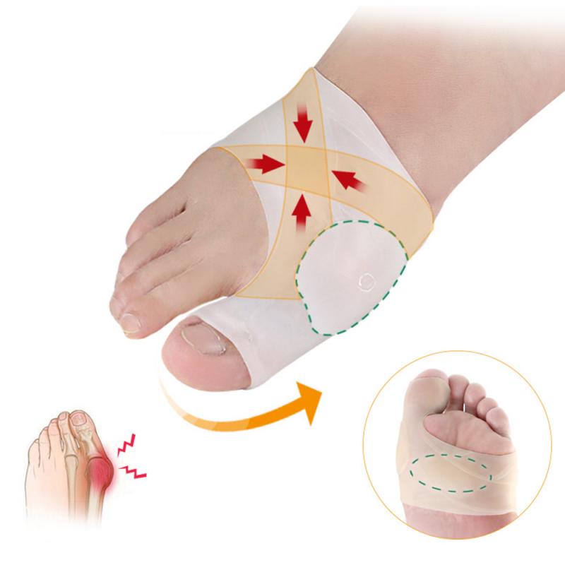 Isovarvas päällekkäisyys silikoni hallux valgus korjain varpaan erottimet nuppi korjaimet jalka sormi halkaisija varpaan suoja ortoosi