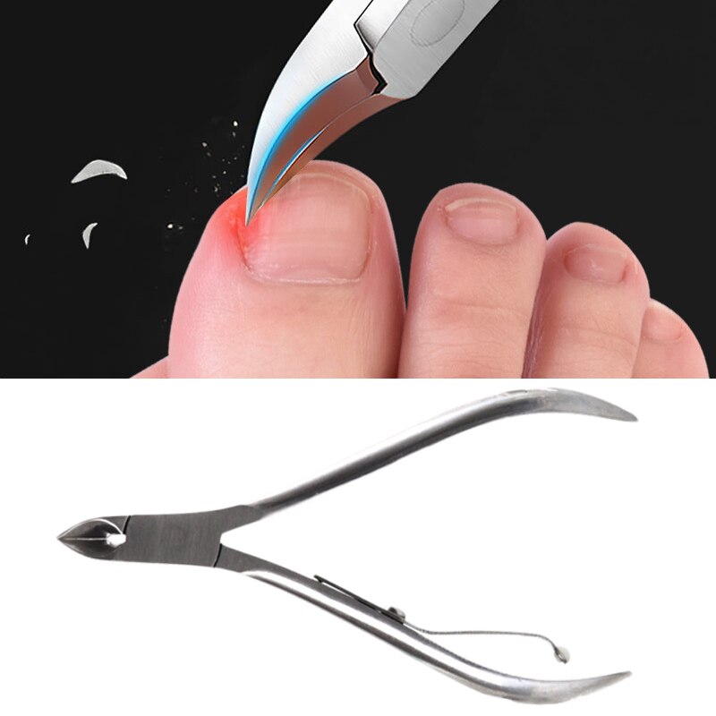 2 stücke Eingewachsene Finger Kappe Nagel Korrektur Zangen Nagel Clipper Schneider Toten Haut Schmutz Entferner Paronychie Podologie Pediküre Werkzeuge