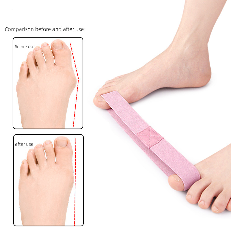 1 st stortårem, hallux valgus-korrigerare, stretchigt bälte, tåsträckare, justering för hallux valgus-korrigerare, lindring av fotsmärta
