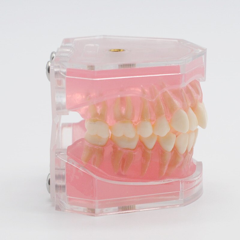 Modelo de enseñanza de goma suave extraíble, modelo tipodno para estudio de laboratorio Dental