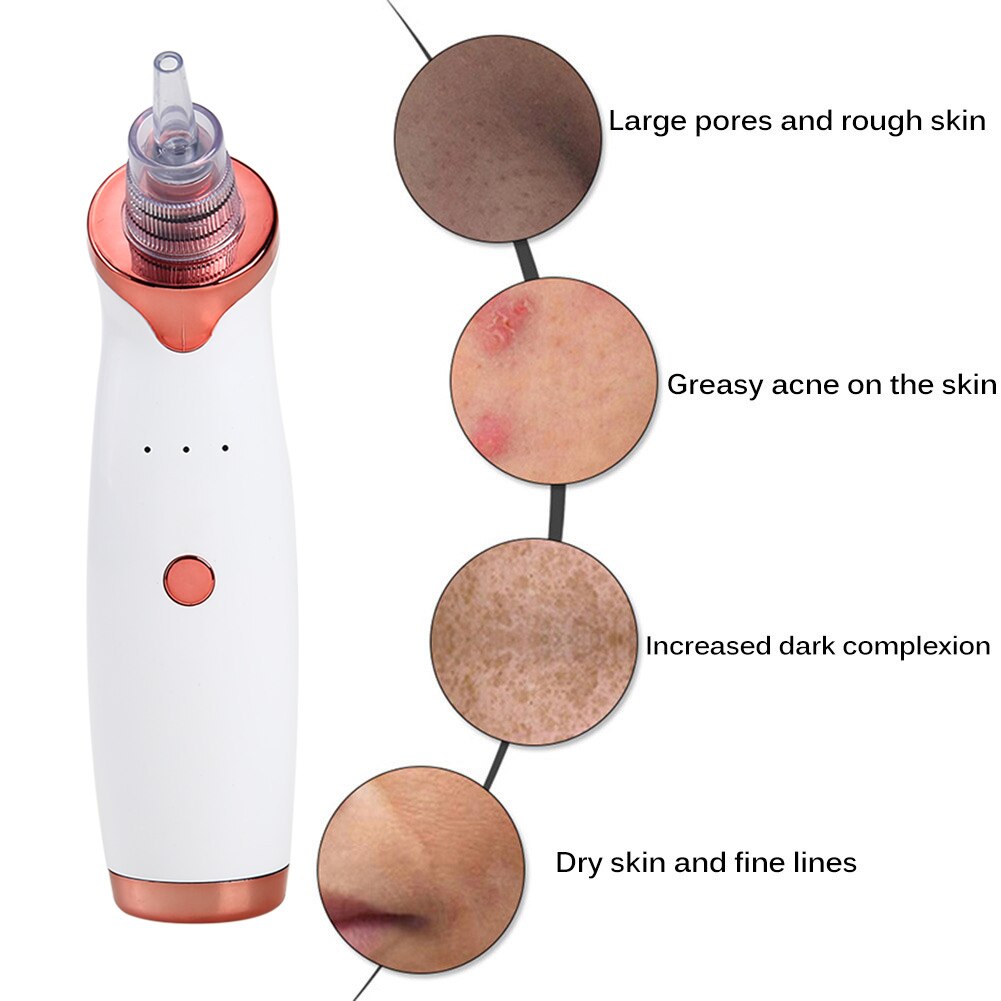 Blackhead Remover Facial Electric Acne Cleaner Blackhead Black Point Vacuum Cleaner Tool Black Spots Pore Cleaner Machine