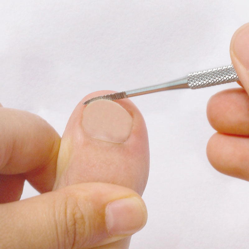 Double Ended Ingrown Toe Nail Lifter File Toenail Paronychia Podiatry Manicure Pedicure Nail Care Hook Foot Clean Tool