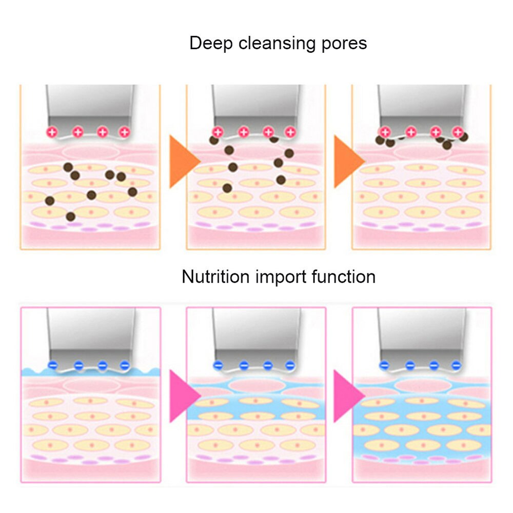 Ultrasonic Skin Scrubber Deep Cleaning Face Scrubber Vibrating Facial Cleansing Skin Spatula Peeling Beauty Instrument Device