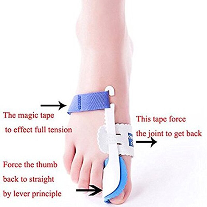 1 Paar Tenen Protector Grote Teen Straightener Bunion Hallux Valgus Corrector Nacht Spalk Voet Voeten Care Pain Relief Spalk