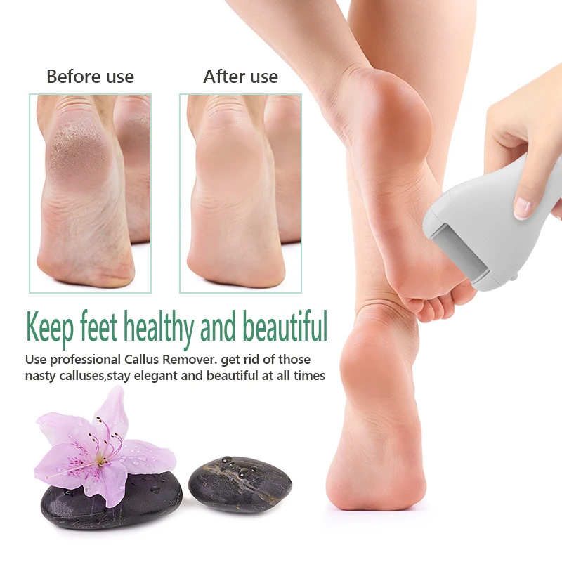 Elektrische Pedicure Voet Bestand USB Oplaadbare Power Display, 3 stks Slijpen Peeling Vervanging Hoofden Voor Hiel Eelt Remover