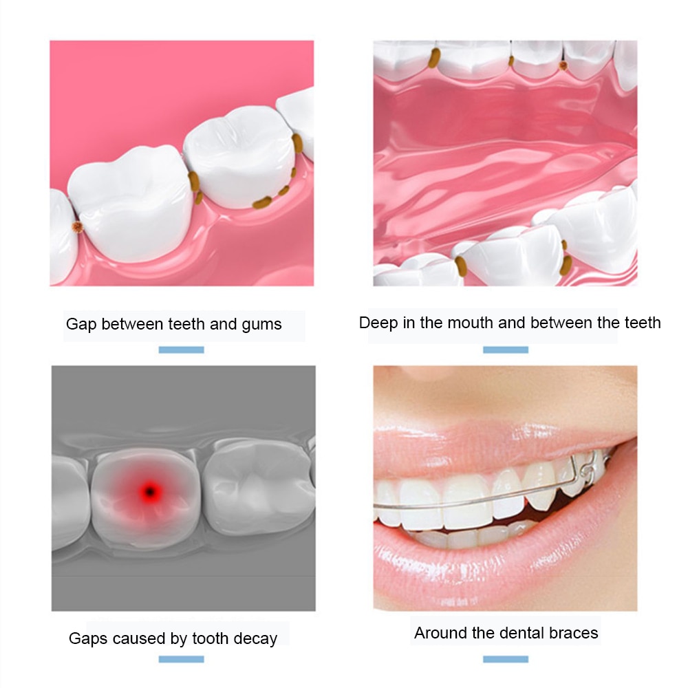 Oral Irrigator Dental Water Flosser Tips USB Rechargeable Water Jet Flosser Ipx7 Irrigator Teeth Whitening Oral Caring Tool