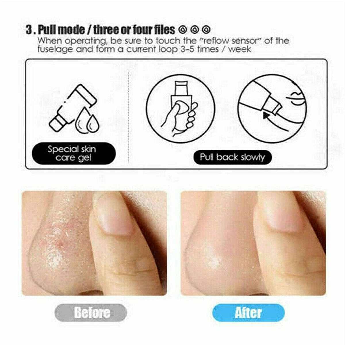 Ultrasonic Skin Scrubber Deep Cleaning Face Scrubber Vibrating Facial Cleansing Skin Spatula Beauty Instrument Device