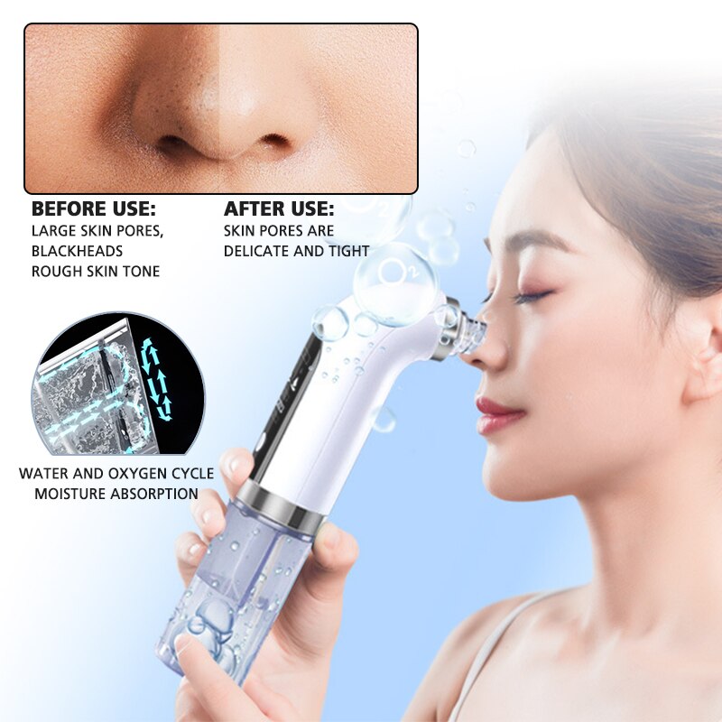 Electric Small Bubble Blackhead Remover Vacuum Black Dots Deep Face Cleansing Acne Pimple Remover Pore Remover Skin Cleaner: no acne needle 01