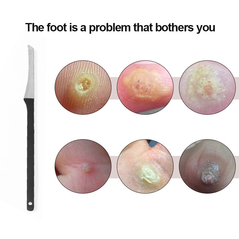 Stainless Steel Foot Corn Remover Pedicure Knife Corn Cuticle Cutter Dead Skin Remover Rasp Scraper Pedicure Foot Callus Care