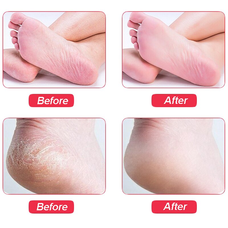 Practical Dead Skin Cocoon Remover Foot Care Tools Foot File Rubbing Skirting Pedicure Sand Washing Feet Brush File 1PC