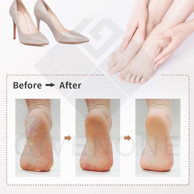 Electric Foot File Two-Speed Adjustment Pedicure Tools Dead Skin Callus Remover USB Foot Grind Machine Portable Foot Care Tool