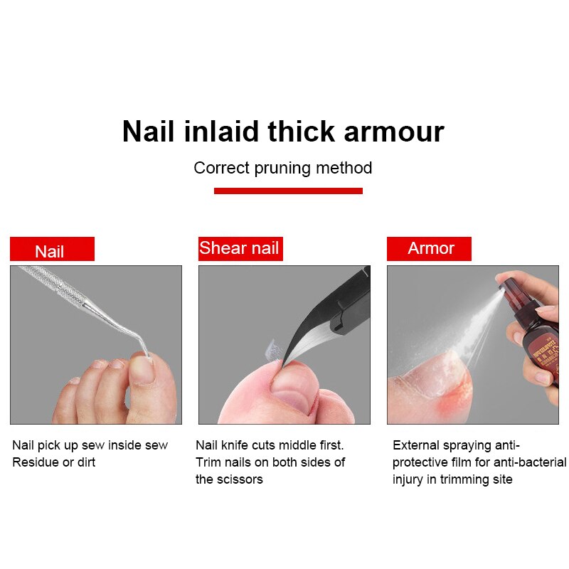 Stainless Steel Nail Clipper Pedicure Tool Toenail Ingrown Eagle Hook Nipper Paronychia Dead Skin Remover Trimming