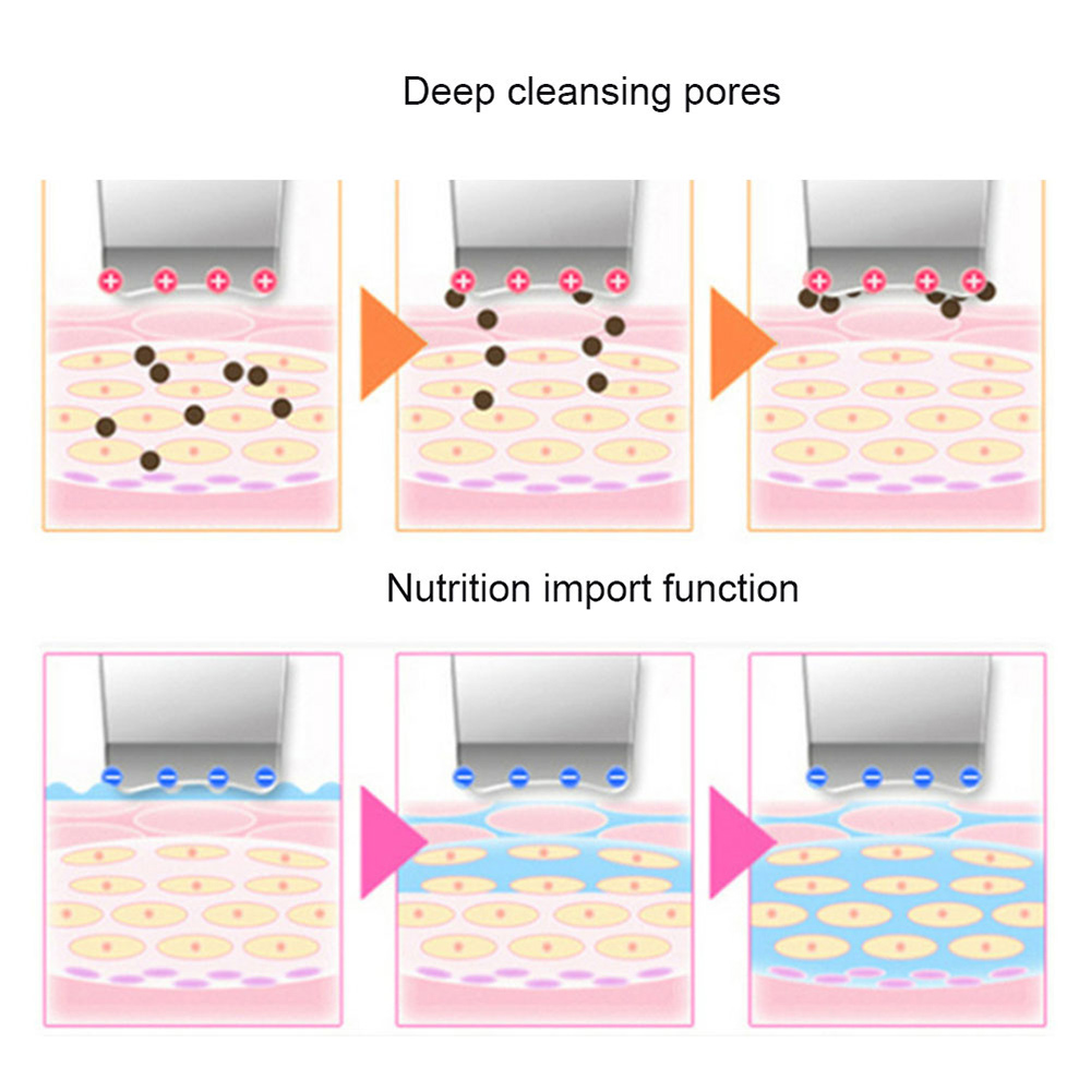 Ultrasonic Skin Scrubber Deep Face Cleaning Machine Peeling Shovel Facial Pore Cleaner Face Skin Scrubber Lift Machine