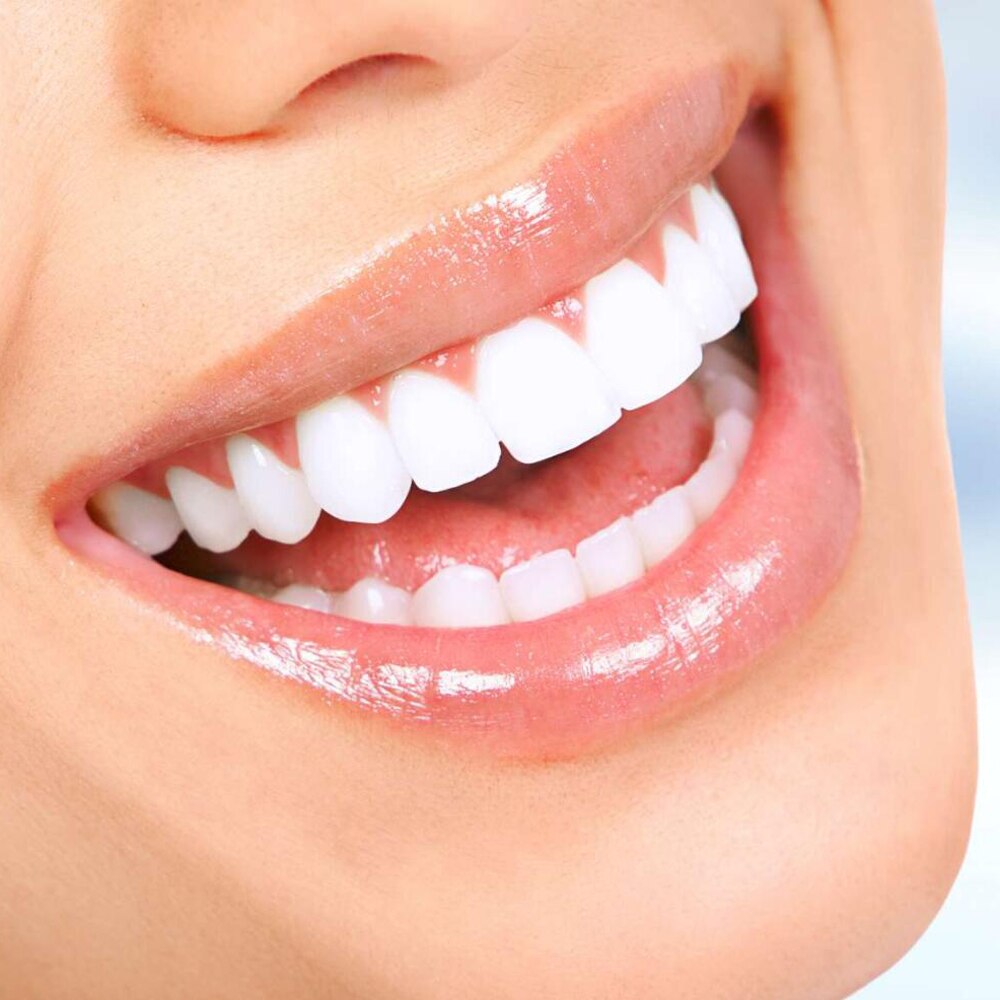 4pcs SOOCAS X3 X1 Replacement Toothbrush heads for Xiaomi electric tooth brush Ultrasonic Whitening Teeth Oral Hygiene