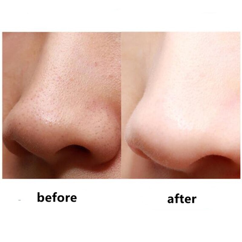Usb ultralyds-hudscrubber hudormefjerner ansigtsscrubber-rens ansigts-porerens ansigtsløftning ansigtshudskraber