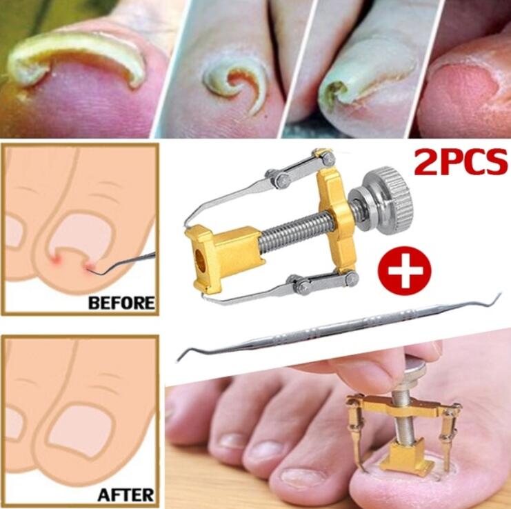 Ingrown Toenails Pedicure Foot Care Tool Nail Correction Clipper ...