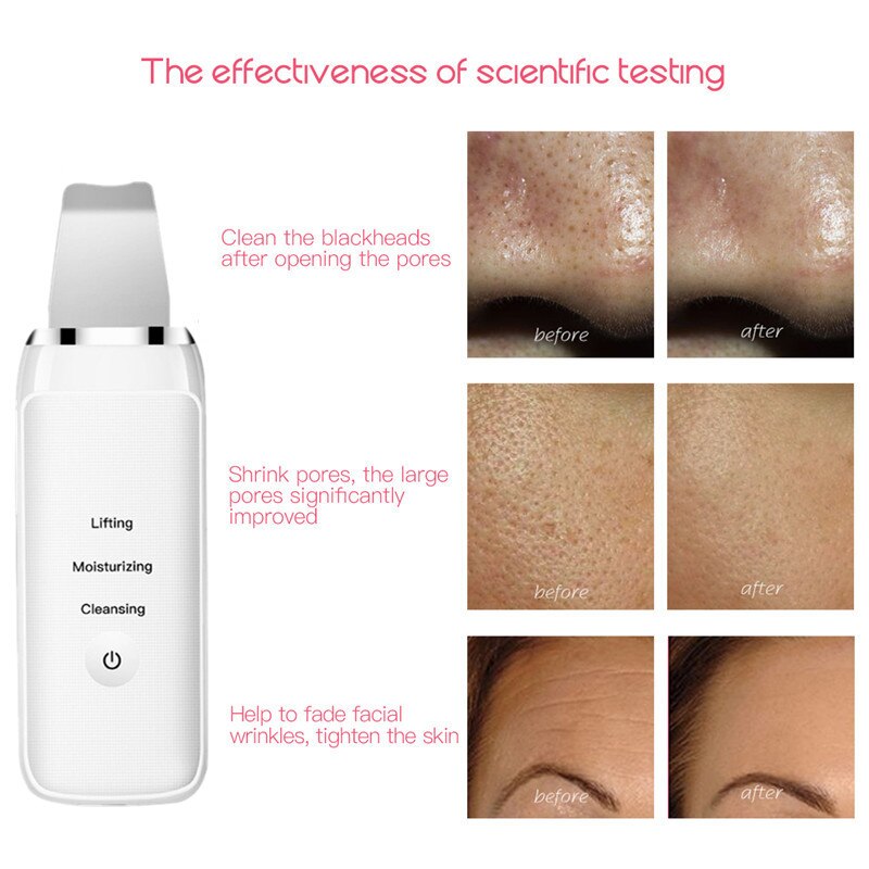 Tlinna ultrasone huidscrub diepe gezichtsreiniging verwijdert vuil, mee-eters vermindert rimpels, whitening liftende massage-apparaat