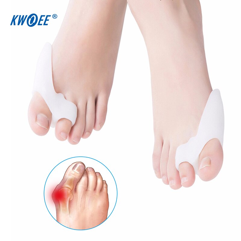 2 stuks Tenen Overlappende Separator Voet Hallux Valgus Orthese Tenen Aligner Siliconen Bunion Care Voetverzorging Tool Teen Separator