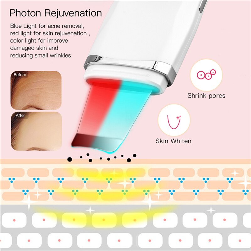 Ckeyin Ultrasone Facial Skin Scrubber Gezicht Spatel Led Photon Ems Ion Diepe Reiniging Huid Peeling Peeling Comedondrukker