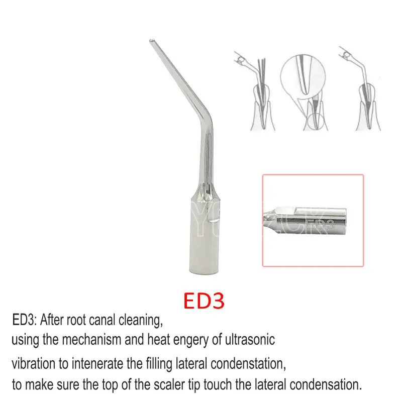 Puntas de escalador ultrasónico Dental, compatibles con escalador ultrasónico Satelec/DTE ED1/ED2/ED3/ED4/ ED5, 1 ud.: Negro