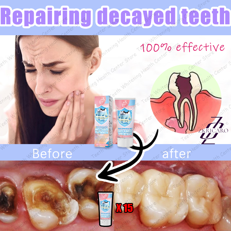 Latest Teeth Cleaning to Eliminate Tooth Decay