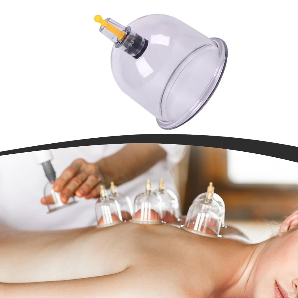 1 Stück Vakuum-Schröpfglas für Massage, Chinesische Medizin, Physiotherapie, Anti-Zellulitis Saugnapf, Körpermassagegerät für Gesundheitspflege