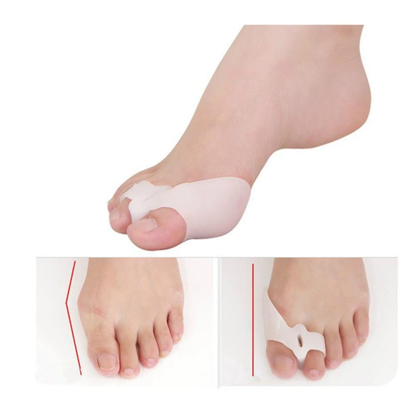 De Gel de silicona para juanetes, separador de dedos grande, alivia el dolor de pies, halux Valgus, protector de corrección de pie, cuidado de los pies 1 par