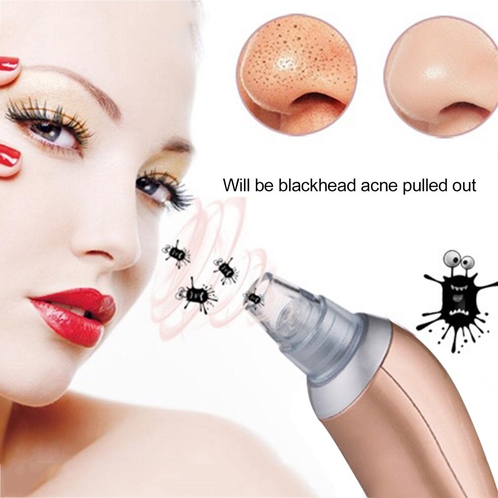 Vacuum Blackhead Remover Electric Facial Vacuum Pore Cleaner Spot Acne Removal Vacuum Suction Extraction Face skin care tool