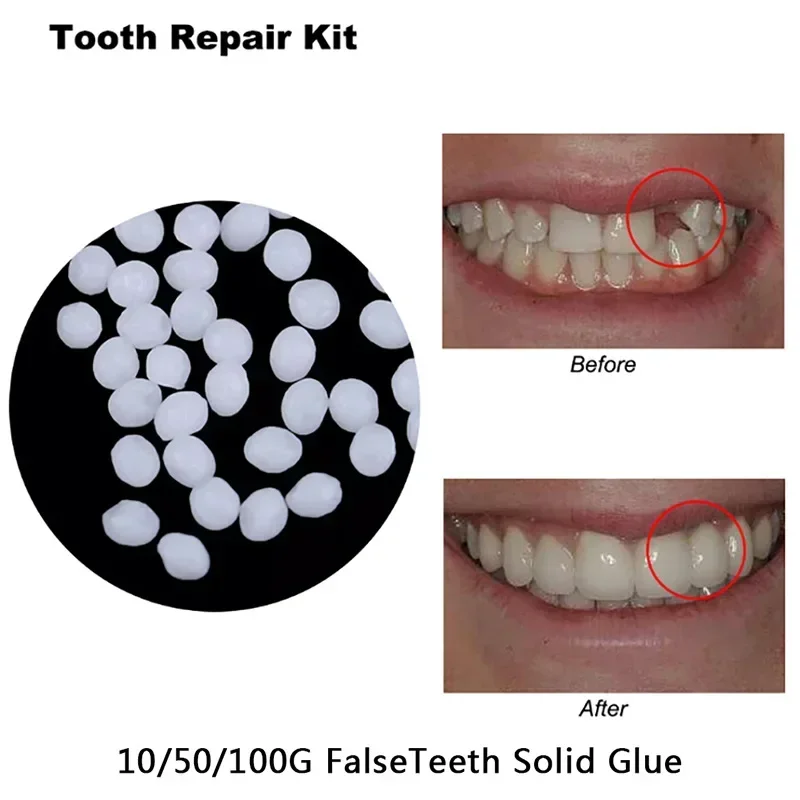 5-100ml Harz Zahn reparatur kleber formbare Zahnlücken füllen feste temporäre Zähne reparieren False teeth Kleber Sicherheit zahn ärztliche Versorgung