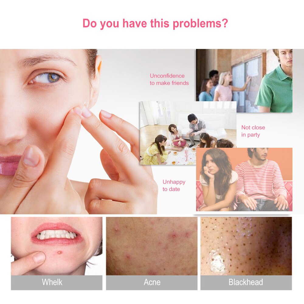 2Pcs Acne Remover Blackhead Tool Stainless Steel Facial Pimple Blackhead Blemish Kit Facial Cleaning Helper Double-ended