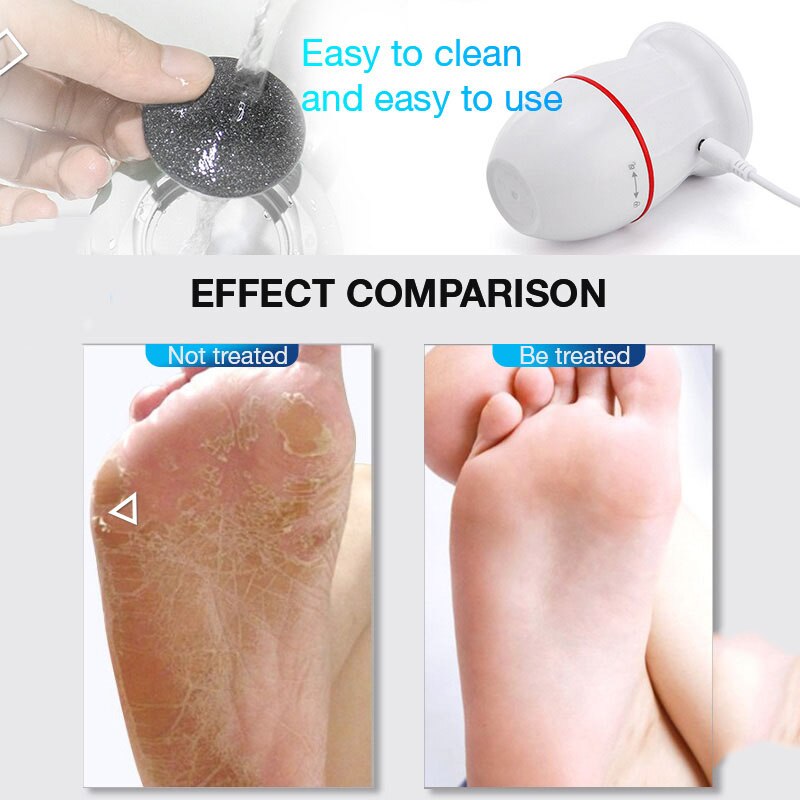 Electric Vacuum Adsorption Foot Grinder Pedicure Tools Foot Care Tool Remover Absorbing Machine Dead Skin Callus Polisher