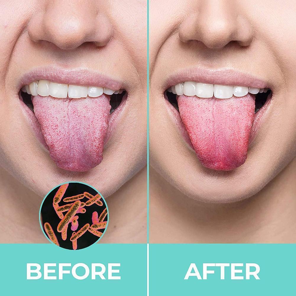 1PCS Tongue Scraper Steel Tongue Cleaner Toothbrush Hygiene High Brush Tongue Y8F1