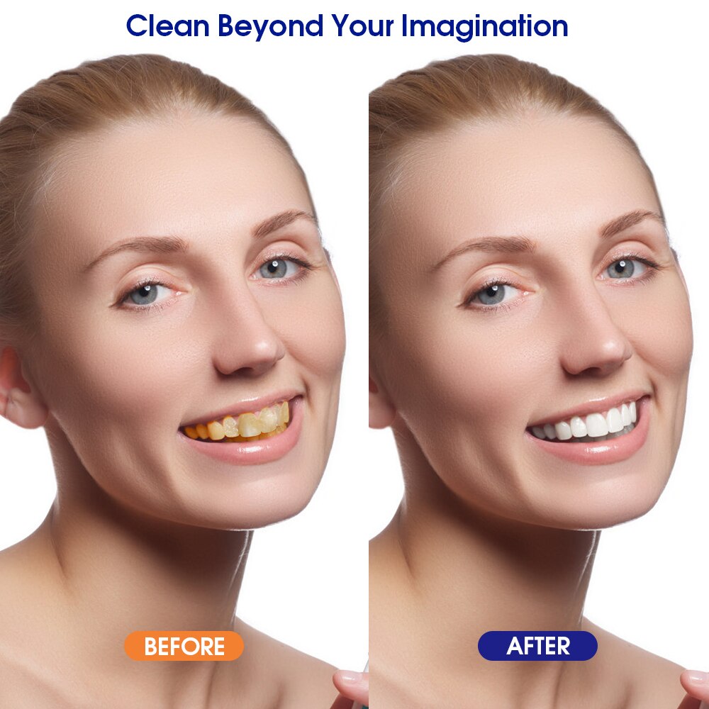 Removedor de cálculo dental elétrico, raspador de tártaro xpreen com 3 cabeças de limpeza-uso doméstico kit de ferramentas de raspador de tártaro incluindo denta