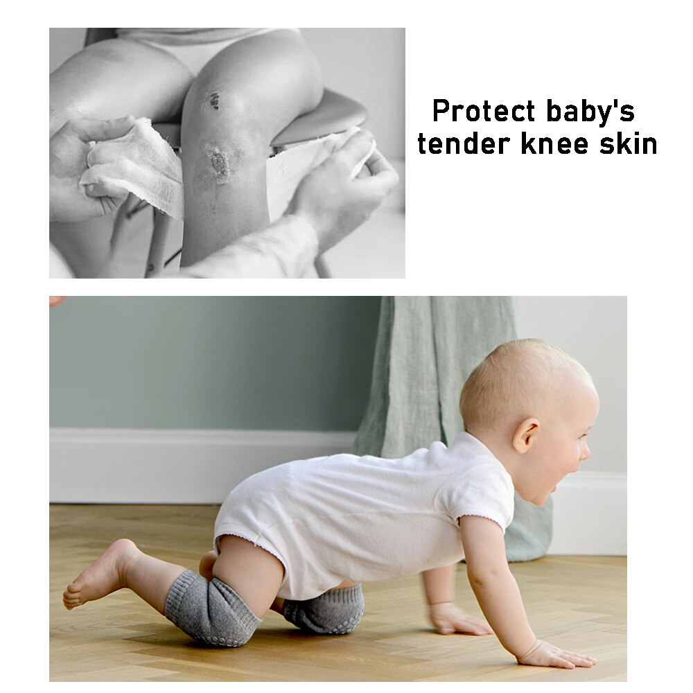 Antislip Baby Kneepad Baby Peuter Kruipen Veiligheid Accessoires Kind Knie Pads Protector Kussen Kneepad Been Warmer Meisjes Jongens