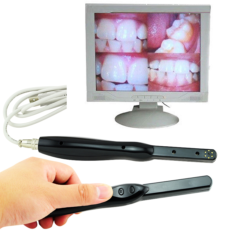 Orthodontische Beugels Oral Care Dental HD USB 2.0 Intra Orale Camera 6 Megapixels 6-LED Helder Beeld
