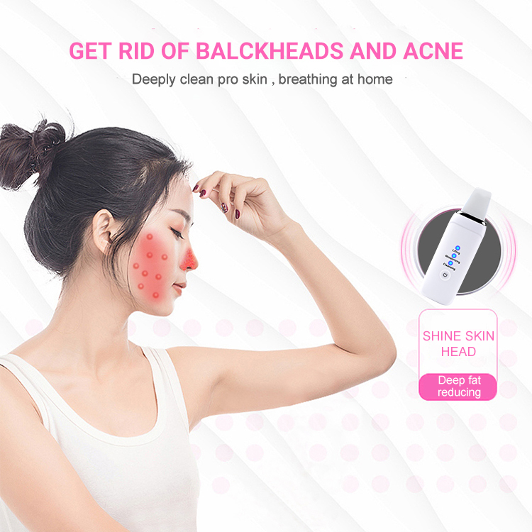 Ultrasonic Face Scrubber Skin Scrubber Deep Face Cleaning Machine Blackhead Remover Face Cleansing Brush Usb Facial Lifting