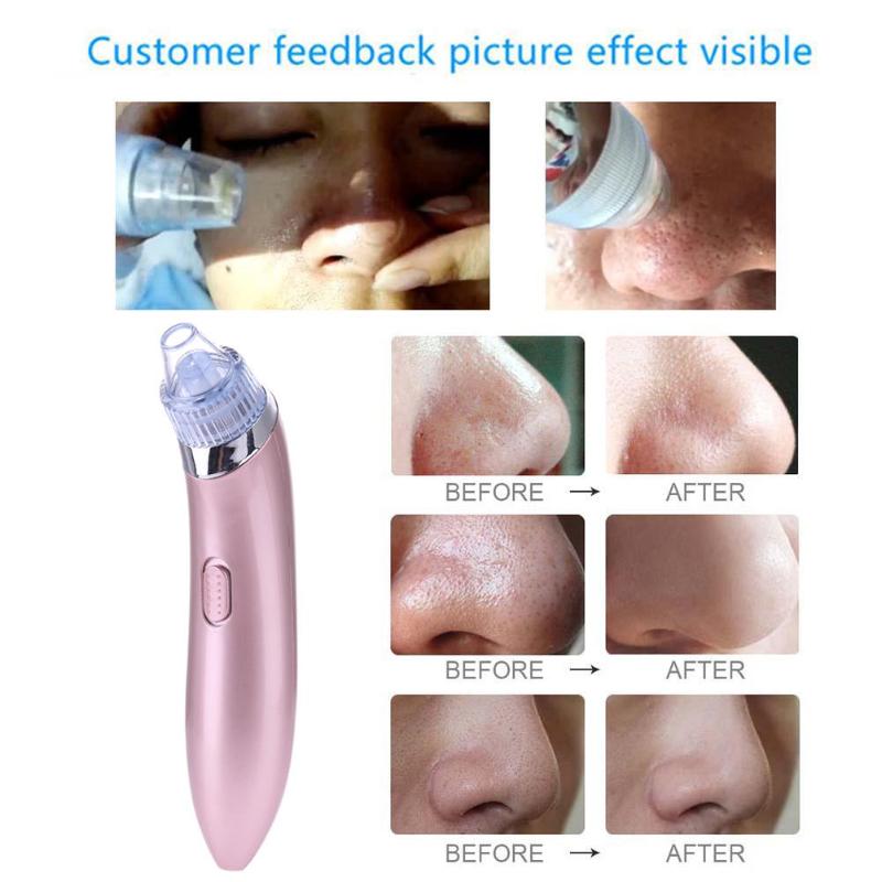 Aspirateur électrique nettoyeur de pores Pro points noirs aspirateur acné propre exfoliant nettoyage Comedo aspiration pores nettoyant soins de la peau