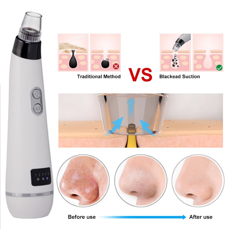 ROSALIND Blackhead Remover Facial Vacuum Pore Cleaner Face Skin Care Pimple Remover Nose Acne Comedo Suction Spot Cleaner