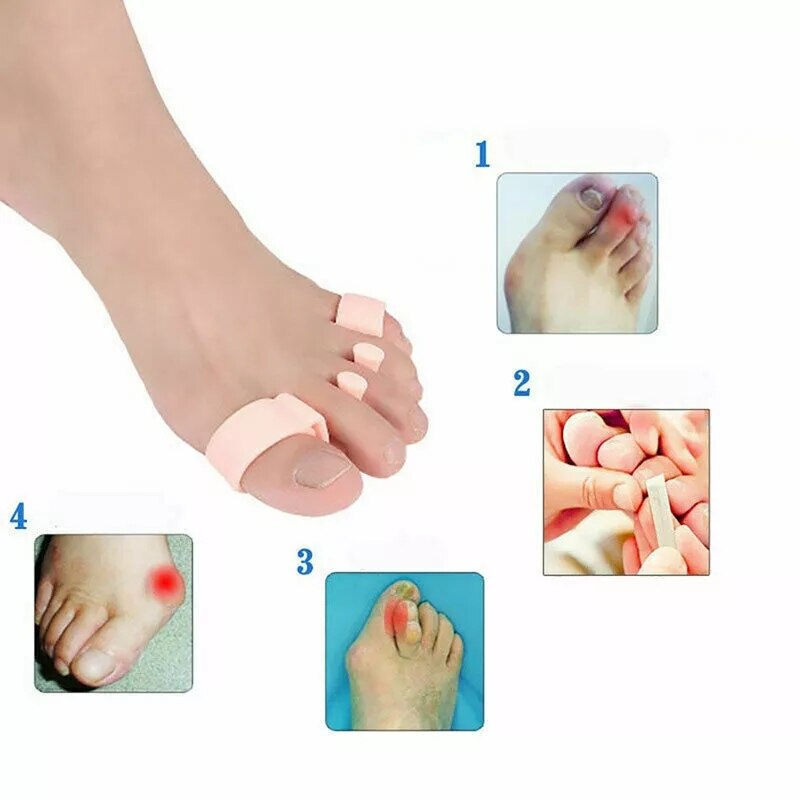 Corretor de joanete ortopédico, separador de dedos dos pés, alisador de hálux valgus, protetor de dedos espaçadores para cuidados com os pés, 6 peças = 3 pares