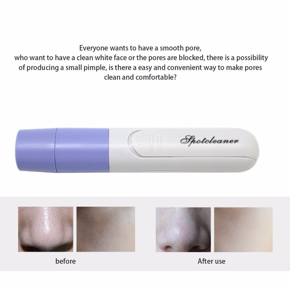 Mini Portable Blackhead Remover Tool Vacuum Extractor Acne Suction Exfoliating Pore Cleanser Beauty Instrument