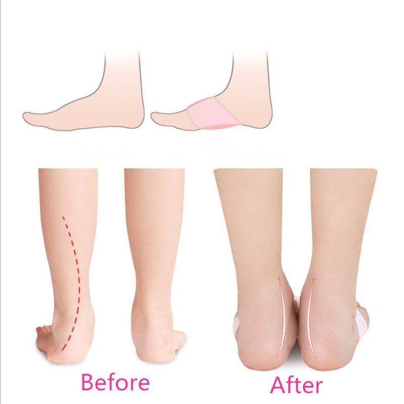 2pcs=1pair Gel Arch Support Pad Protector Granular Arch Pad Flat Foot High Arch Foot Care Pedicure Foot Pad Toe Corrector